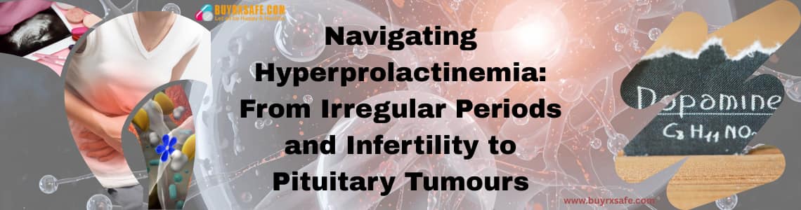Navigating Hyperprolactinemia: From Irregular Periods and Infertility to Pituitary Tumours